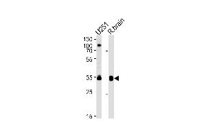 Western blot analysis in U251 cell line and rat brain lysates (35ug/lane). (GNAO1 抗体  (C-Term))