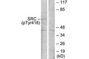 Western blot analysis of extracts from COLO205 cells treated with serum 15% 10', using Src (Phospho-Tyr418) Antibody. (Src 抗体  (pTyr419))