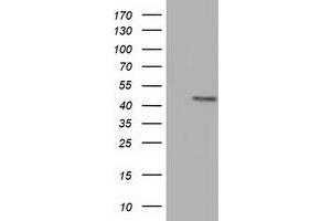 Western Blotting (WB) image for anti-COBW Domain Containing 1 (CBWD1) antibody (ABIN1497114) (CBWD1 抗体)