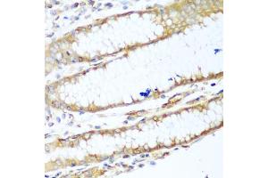 Immunohistochemistry of paraffin-embedded human stomach using MYH9 antibody (ABIN5970029) at dilution of 1/100 (40x lens). (Myosin 9 抗体)