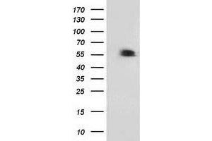 Western Blotting (WB) image for anti-Tumor Protein P53 (TP53) antibody (ABIN1499977) (p53 抗体)