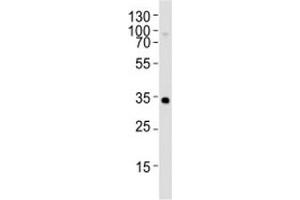 Western blot analysis of lysate from Y79 cell line using OTX2 Anitbody at 1:1000. (OTX2 抗体)