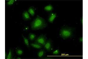 Immunofluorescence (IF) image for anti-Cerebellar Degeneration-Related Protein 2, 62kDa (CDR2) (AA 296-404) antibody (ABIN560316)