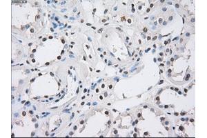 Immunohistochemistry (IHC) image for anti-Fc Fragment of IgG, Low Affinity IIa, Receptor (CD32) (FCGR2A) antibody (ABIN1497262) (FCGR2A 抗体)