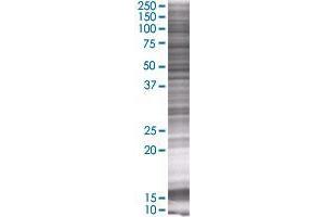 MOGAT3 transfected lysate. (MOGAT3 293T Cell Transient Overexpression Lysate(Denatured))