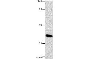 Western blot analysis of K562 cell, using POU5F1 Polyclonal Antibody at dilution of 1:500 (OCT4 抗体)