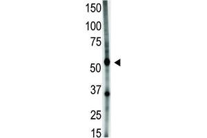 Western Blotting (WB) image for anti-Growth Differentiation Factor 5 (GDF5) antibody (ABIN3001442) (GDF5 抗体)