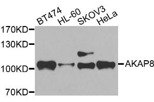 Western blot analysis of extracts of various cell lines, using AKAP8 antibody. (AKAP8 抗体)