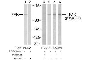 Image no. 2 for anti-PTK2 Protein tyrosine Kinase 2 (PTK2) (Tyr861) antibody (ABIN197234) (FAK 抗体  (Tyr861))