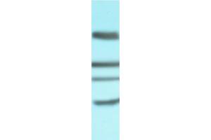 Western Blotting (WB) image for anti-CD4 (Clenoliximab Biosimilar) antibody (ABIN5668247)