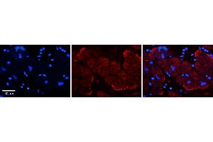 Rabbit Anti-AKAP7 Antibody    Formalin Fixed Paraffin Embedded Tissue: Human Adult heart  Observed Staining: Membrane Primary Antibody Concentration: 1:600 Secondary Antibody: Donkey anti-Rabbit-Cy2/3 Secondary Antibody Concentration: 1:200 Magnification: 20X Exposure Time: 0. (AKAP7 抗体  (N-Term))