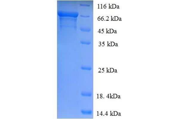 IDUA Protein (AA 28-653) (His tag)