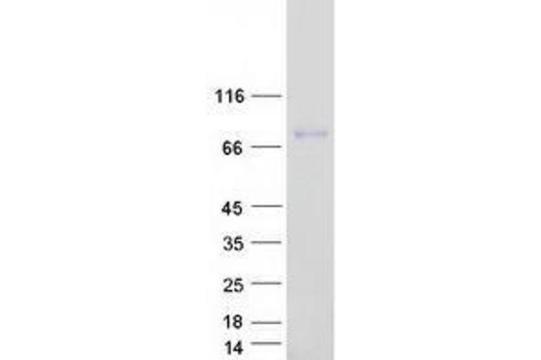 IGFALS Protein (Myc-DYKDDDDK Tag)