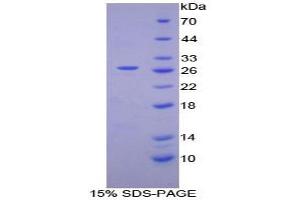 SDS-PAGE analysis of Human Coagulation Factor XII Protein. (F12 蛋白)