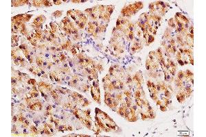 Formalin-fixed and paraffin embedded rat pancreas tissue labeled with Anti-ACE2 Polyclonal Antibody, Unconjugated at 1:200, followed by conjugation to the secondary antibody and DAB staining (ACE2 抗体  (AA 601-700))