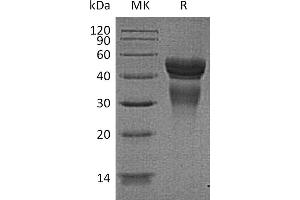 Greater than 95 % as determined by reducing SDS-PAGE. (IL12 蛋白)