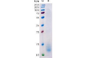 Human BCMA Protein, His Tag on SDS-PAGE under reducing condition. (BCMA Protein (AA 1-54) (His tag))
