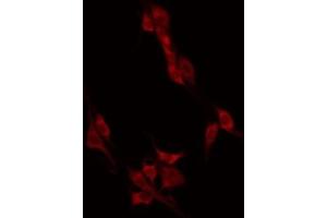ABIN6274946 staining HT29 by IF/ICC. (CAGE1 抗体  (C-Term))