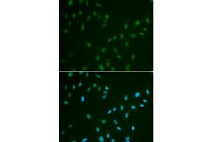 Immunofluorescence analysis of A549 cells using HSF2 antibody. (HSF2 抗体)