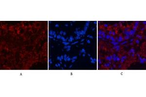 Immunofluorescence analysis of rat lung tissue. (CD4 抗体)