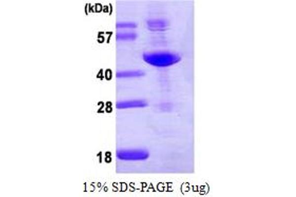 ADA Protein (AA 1-363) (His tag)