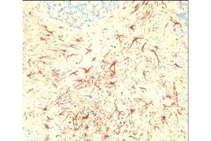 Immunohistochemical staining on mouse brain sections using C5aR antibody ABIN113333. (C5AR1 抗体  (C-Term))