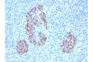 Immunohistochemistry (IHC) image for anti-Tumor Necrosis Factor alpha (TNF alpha) antibody (ABIN6940753)