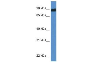 WB Suggested Anti-Sik1 Antibody   Titration: 1. (SIK1 抗体  (Middle Region))