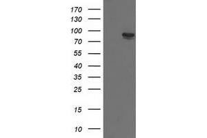 HEK293T cells were transfected with the pCMV6-ENTRY control (Left lane) or pCMV6-ENTRY TRIM2 (Right lane) cDNA for 48 hrs and lysed. (TRIM2 抗体  (AA 1-100, AA 645-744))