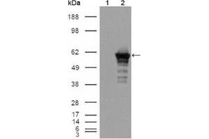 Western Blotting (WB) image for anti-Desmin (DES) antibody (ABIN1106977) (Desmin 抗体)