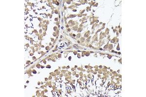 Immunohistochemistry of paraffin-embedded rat testis using METTL4 Rabbit pAb (ABIN6133091, ABIN6143773, ABIN6143774 and ABIN6224964) at dilution of 1:100 (40x lens). (METTL4 抗体  (AA 1-190))