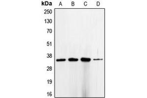 Western blot analysis of CDC2 expression in HeLa (A), K562 (B), MCF7 (C), A431 (D) whole cell lysates. (CDK1 抗体  (Center))