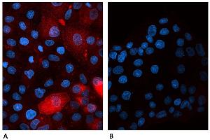 Confocal microscopy of human β2-microglobulin-transfected canine cells labeled A) with B2M-01 antibody Alexa Fluor® 647 conjugate  and B) with Alexa Fluor® 647 conjugated Mouse IgG2a Isotype Control (A6-458-C100). (beta-2 Microglobulin 抗体  (Biotin))