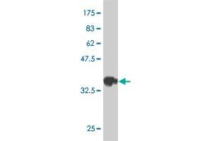 Western Blot detection against Immunogen (37. (FGFR1OP2 抗体  (AA 62-169))