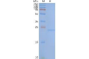 Human TM4SF1-Nanodisc, Flag Tag on SDS-PAGE (TM4SF1 蛋白)