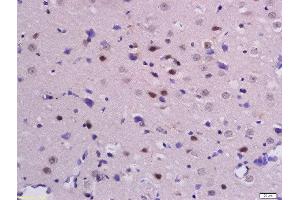 Immunohistochemistry (Paraffin-embedded Sections) (IHC (p)) image for anti-Catenin, beta (CATNB) (pSer33), (pSer37) antibody (ABIN683893)