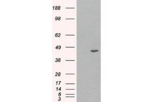 Western Blotting (WB) image for anti-Hydroxy-delta-5-Steroid Dehydrogenase, 3 beta- and Steroid delta-Isomerase 1 (HSD3B1) (C-Term) antibody (ABIN2465829) (HSD3B1 抗体  (C-Term))