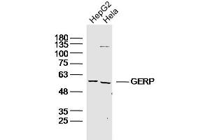 Lane 1: HepG2 lysates Lane 2: Hela lysates probed with GERP Polyclonal Antibody, Unconjugated  at 1:300 dilution and 4˚C overnight incubation. (TRIM8 抗体)