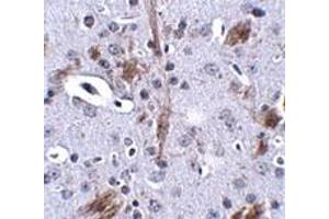 Immunohistochemistry (IHC) image for anti-tau Tubulin Kinase 1 (Ttbk1) (C-Term) antibody (ABIN1030783) (TTBK1 抗体  (C-Term))