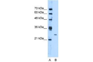 TMEM126B antibody used at 1. (TMEM126B 抗体  (Middle Region))