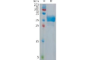 Human C Protein, hFc Tag on SDS-PAGE under reducing condition. (Muscarinic Acetylcholine Receptor M2 Protein (AA 1-22) (Fc Tag))