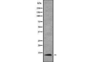 Western blot analysis of RPL37 using Jurkat whole cell lysates (RPL37 抗体  (Internal Region))