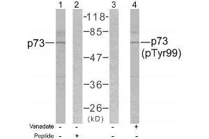 Image no. 1 for anti-Tumor Protein P73 (TP73) (pTyr99) antibody (ABIN196716) (Tumor Protein p73 抗体  (pTyr99))