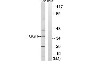 Western blot analysis of extracts from RAW264. (GGH 抗体  (Internal Region))