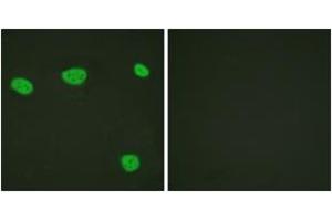 Immunofluorescence analysis of HeLa cells, using Vitamin D Receptor (Ab-208) Antibody. (Vitamin D Receptor 抗体  (AA 181-230))