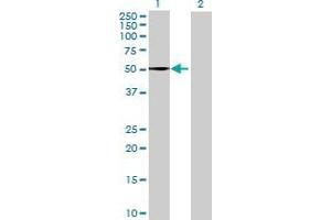 Lane 1: QRSL1 transfected lysate ( 58. (QRSL1 293T Cell Transient Overexpression Lysate(Denatured))