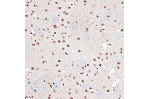 Immunohistochemistry of paraffin-embedded mouse brain using RBM3 antibody  at dilution of 1:100 (40x lens). (RBM3 抗体  (AA 1-157))