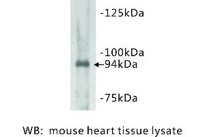 Image no. 1 for anti-Junctophilin 2 (JPH2) antibody (ABIN1112815) (Junctophilin 2 抗体)