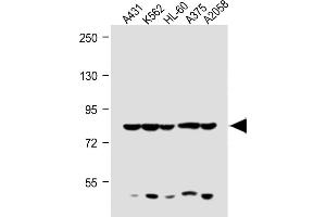 All lanes : Anti-ABCB5 Antibody (N-term) at 1:1000 dilution Lane 1: A431 whole cell lysate Lane 2: K562 whole cell lysate Lane 3: HL-60 whole cell lysate Lane 4:  whole cell lysate Lane 5:  whole cell lysate Lysates/proteins at 20 μg per lane. (ABCB5 抗体  (N-Term))