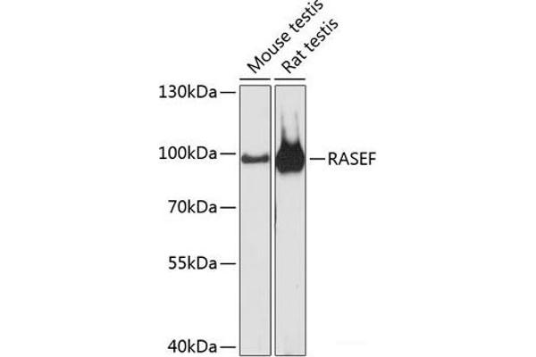 RASEF 抗体